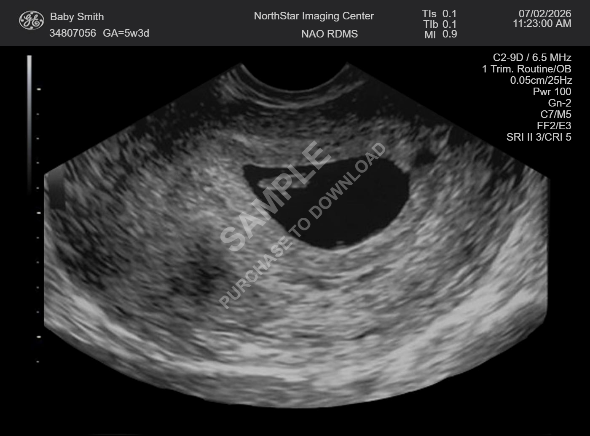 Custom Scan Generator